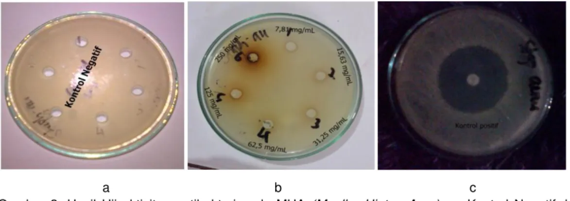 Gambar  3.  Hasil  Uji  aktivitas  antibakteri  pada  MHA  (Mueller  Hinton  Agar)    a