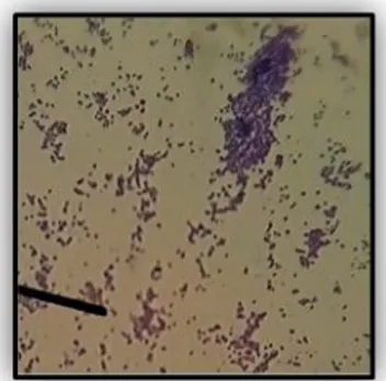 Gambar 1. Uji Mikroskopis Bakteri Staphylococcus aureus Pembesaran 450 ×  Tabel 6. Hasil Uji Katalase 