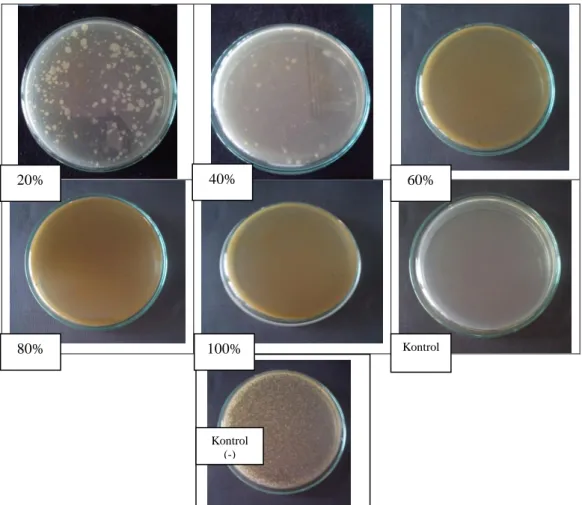 Gambar 2. Jumlah Koloni bakteri Shigella dysenteriae pada media NA setelah perlakuan dengan ekstrak Phyllanthus 