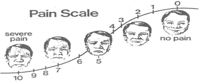 Gambar 2.7.4. Visual Analogue Scale. 29 