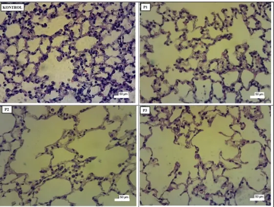 Gambar 4. Gambaran Mikroskopis Luas Alveolus Paru-Paru Mencit (Mus musculus) Pewarnaan 