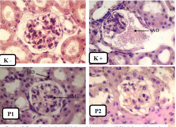 Gambar 2. Foto mikroskopis ginjal kelompok kontrol negatif (K - ), kelompok kontrol   positif (K + )  , kelompok madu (P1)  dan kelompok N-Acetylsysteine (P2) 