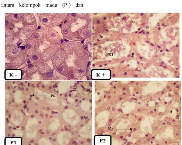 Gambar 2. Foto mikroskopis ginjal kelompok kontrol negatif (K - ), kelompok kontrol   positif (K + )  , kelompok madu (P1)  dan kelompok N-Acetylsysteine (P2) 