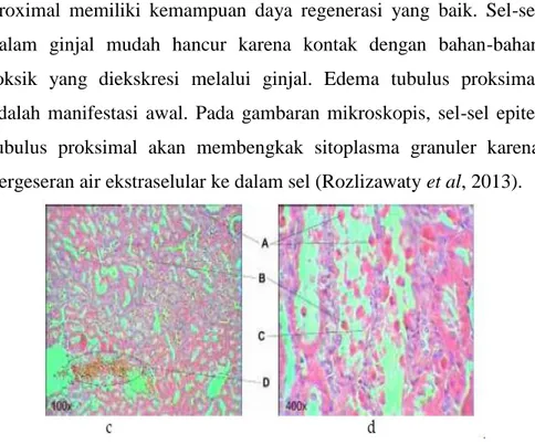 Gambar 2.4. Histopatologi Ginjal Tikus Model Hiperurisemia  A. Nekrosis sel, B. Sel epitel tubulus nekrosis, C
