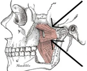 Gambar 2.6 Otot Pterigoideus Medialis