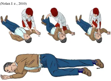Gambar 2.8 Recovery position (sumber: ERC guidelines, 2010) 