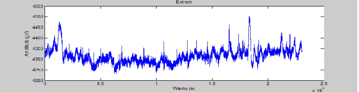 Gambar 4. Hasil Extract Data