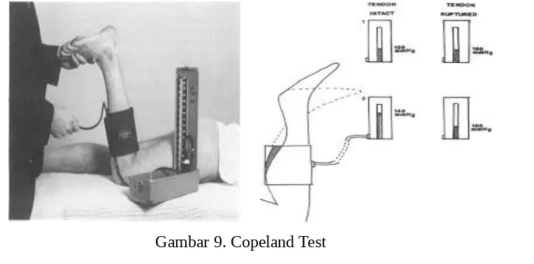 Gambar 9. Copeland Test                    