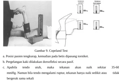 Gambar 9. Copeland Test                    