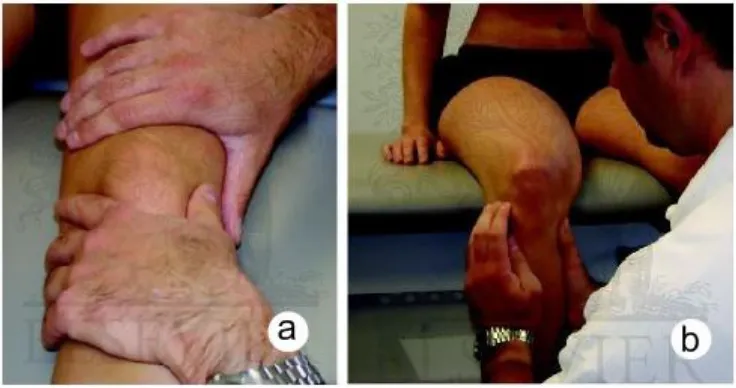 Gambar 4. Pemeriksaan Lokalis pada Sendi Lutut