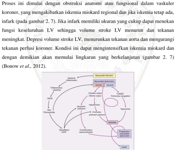 Gambar 2. 7 Sirkulasi regulasi pada STEMI (Bonow et al., 2012)  2.9  Diagnosis Infark Miokard Akut 