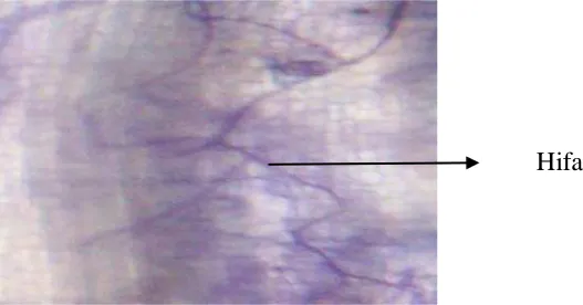 Gambar 9. Hifa yang terdapat pada jaringan akar mindi oleh adanya infeksi mikoriza  (CMA)  