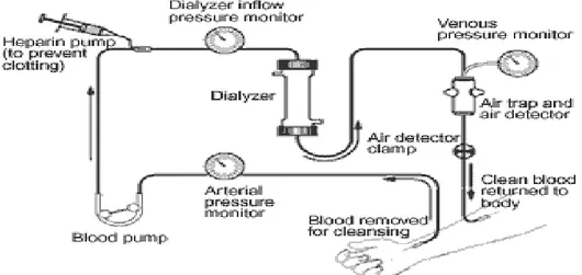 Gambar 2.2  Alur Proses Hemodialysis 