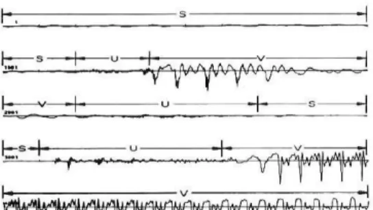 Gambar 2.2 contoh dari sinyal suara manusia  Sinyal suara  memiliki frekuensi kerja antara  0  sampai  5  KHz