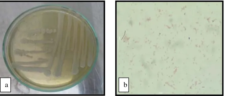 Gambar 3.  Aeromonas hydrophila (a) Makroskopis (b) Mikroskopis 