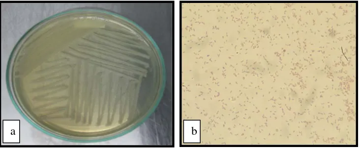 Gambar 4. Edwardsiella tarda (a) Makroskopis (b) Mikroskopis 