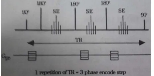 Gambar 2.3 Time Repetition atau waktu pengulangan pada Fast spin echo 
