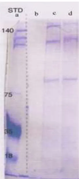 Gambar  2  menunjukkan  bahwa  pita  hanya  tampak  jelas  pada  sampel  c  dan  d  terlihat 3 pita yang  jelas tampak