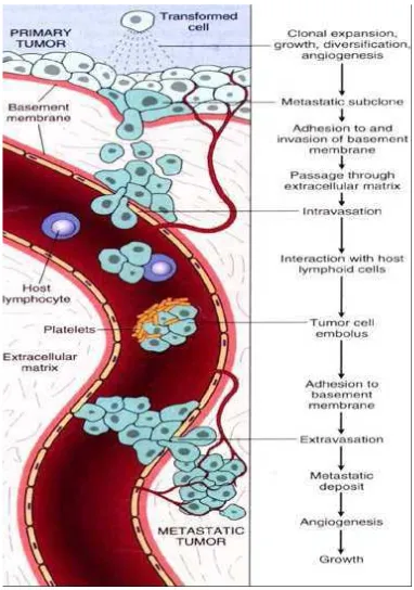 Gambar 2.3 Metastasis sel kanker melalui pembuluh limpoid 