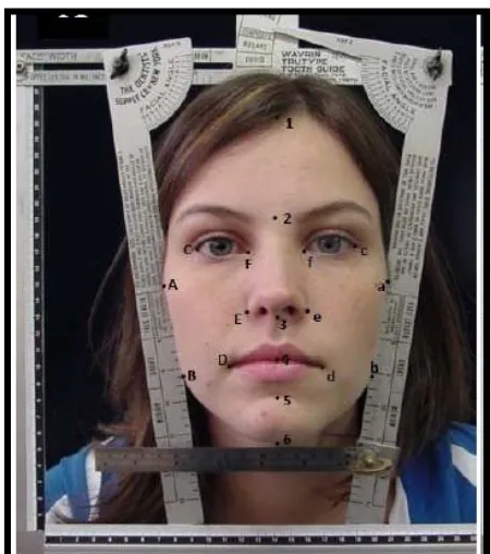 Gambar 5. Titik-titik biometrik dalam analisis      wajah menurut Lucas dkk21 
