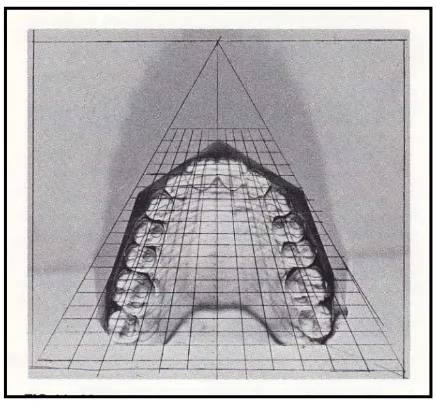 Gambar 7. Symmetrograph 23