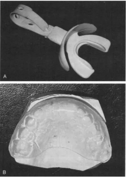 Gambar 4. A)                                     B) Stock mouthguard Custom-made mouthguard14