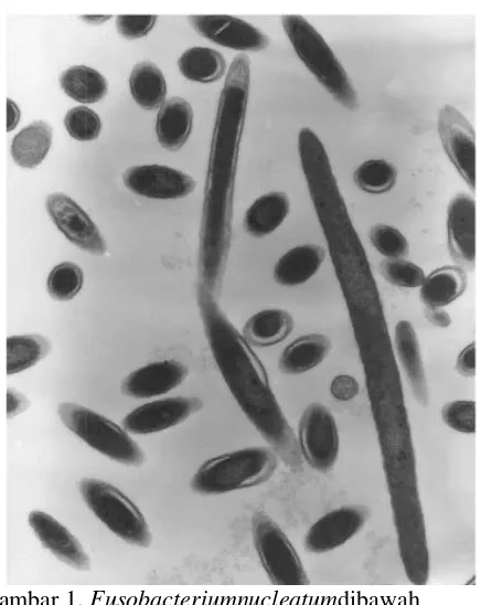 Gambar 1. Fusobacteriumnucleatumdibawah  