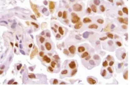 Gambar 2.13 Gambar pewarnaan hemotoksilin dan eosin pada cell block 