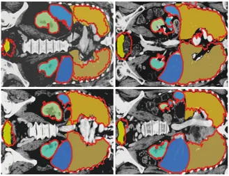 Fig. 2. From left to right: (upper row) Worst, bottom 10 %; (lower row) top 10 % andbest results from the 20 evaluated CT images