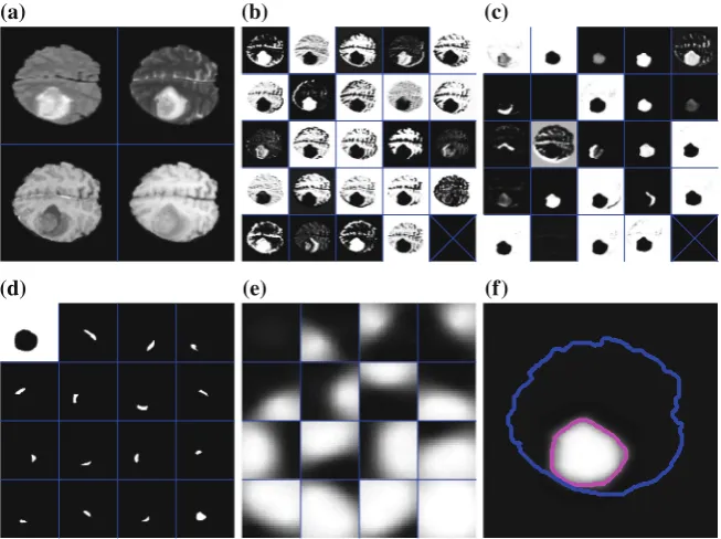 Fig. 4. Sequential processing of multimodal slice (a). (b) and (c) show all 24 outputs ofthe ﬁrst and the second convolutional layer