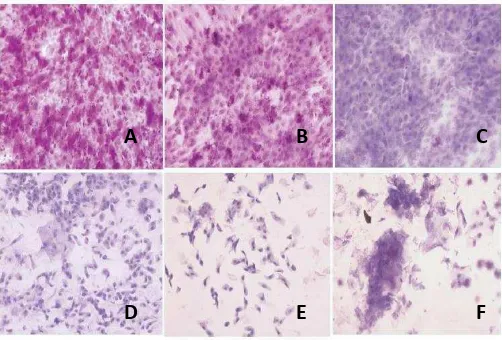 Gambar 2.4. Gambaran hasil sitologi impresi (pewarnaan PAS dan hematoksilin, 