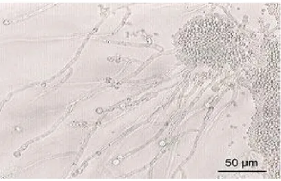 Gambar : 2.4 Candida albicans