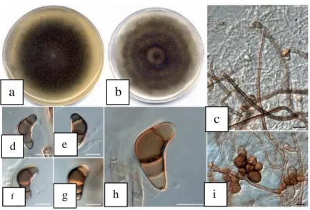 Gambar  4.  Kenampakan  mikroskopis  Fusarium  oxysporumKeterangan:.a)  Fusarium  oxsporum  asal  hutan  mangrove  (Selvi,  K