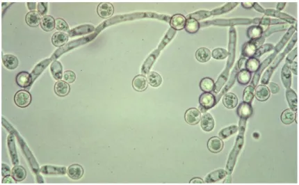 Gambar 6. Candida albicans