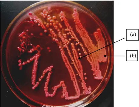 Gambar  2.  Hasil  inokulasi  sampel  urine  pada  Mac  Conkey  Agar  (MCA).  (a)  E.  coli  dan  (b)  Klebsiella spp