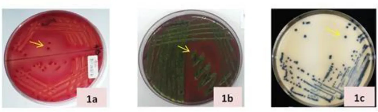 Gambar 1 Koloni diduga E. coli penghasil ESBL.1a: koloni pada MacConkay Agar, 1b: koloni pada L-EMBA, dan 