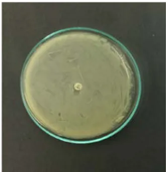 Gambar 1: Uji Resistensi Escherichia coli 