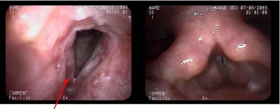 Gambar 2.3 Eritemia/ hiperemia (Pham 2009) 