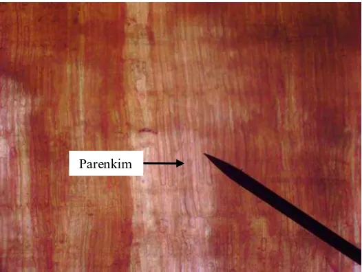 Gambar 7. Parenkim kayu damar (pembesaran 100x) 