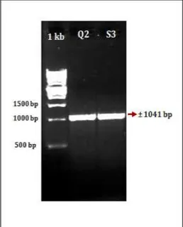 Gambar 2. Produk PCR Rv 1168c     