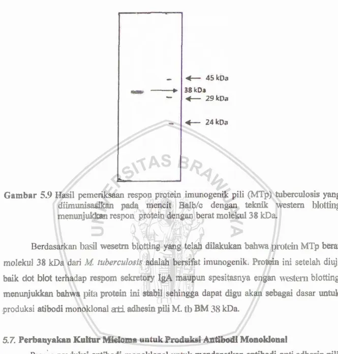 Gambar  5.9  Hasil  pemori-  raspon  protein  immogenik  p a   w p )   tuberculosis  yang  diimuai-  prtda  d t BdWo  dengaa  teknik  westem  blotting 