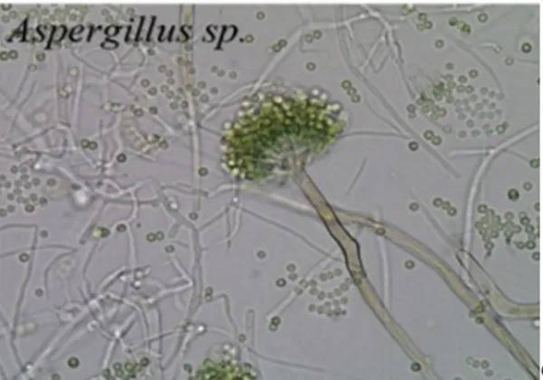 Gambar 6. Aspergillus sp. secara mikroskopis (Seidl, 2006). 