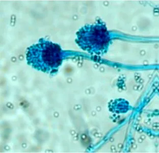 Gambar  12.  Mikromorfologi  Aspergillus  sp.  pada  pembesarn  40X  (Beatrice,                                             2015)  