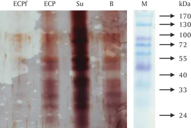 Gambar 1. SDS-PAGE berbagai sediaan vaksin bakteri Mycobacterium fortuitum. M = Marker; ECPf = Vaksin sediaan ECP filter; ECP = Vaksin sediaan ECP; Su = Vaksin sediaan sel utuh; B = Vaksin sediaan broth