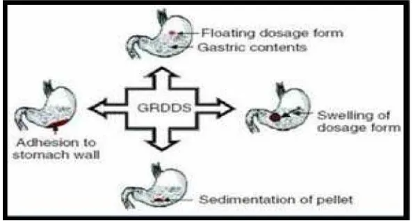 Gambar 2.2 Berbagai metode pendekatan sediaan Gastro Retentive 