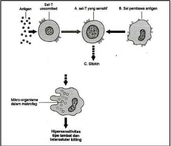 Gambar 1. Patogenesis reaksi likenoid oral36
