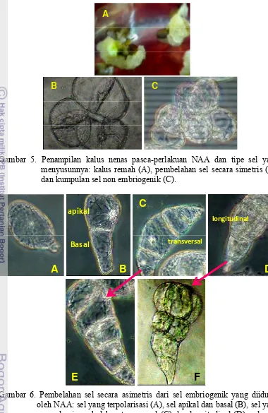Gambar 5. Penampilan kalus nenas pasca-perlakuan NAA dan tipe sel yang 