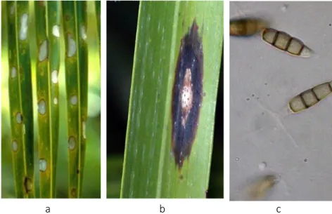 Gambar 17  Gejala bercak daun kelabu (a), perluasan gejala bercak berupa warna  hitam di tepian gejala (b), konidia Pestalotiopsis palmarum (c) 