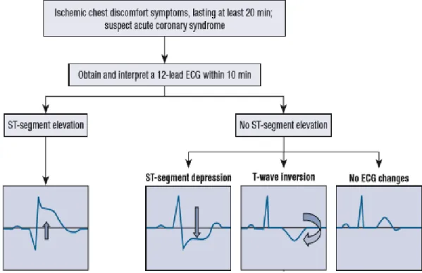Gambar 2. 5 Klasifikasi STEMI  dan  NSTEMI  Berdasarkan  EKG  Pada  Infark  Miokard  Akut