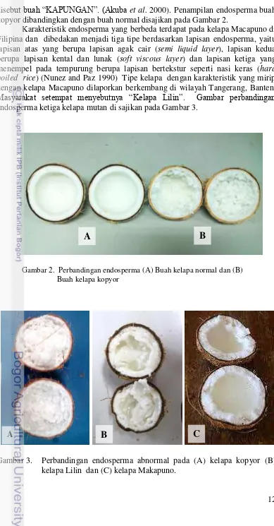 Gambar 2.  Perbandingan endosperma (A) Buah kelapa normal dan (B)  